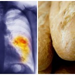 Study: Eating White Bread & Bagels Can Be Worse than Smoking – 49% Increase in Lung Cancer