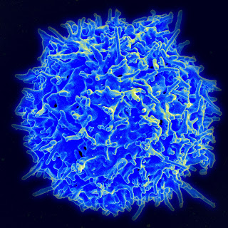 Cancer: Could New T-Cell Research Develop A Cure?