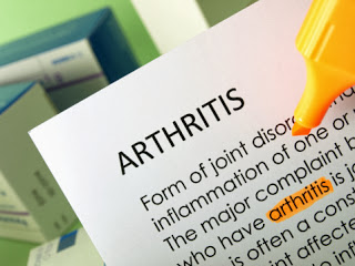 A Review of the Most Effective Alternative Remedies for Osteoarthritis