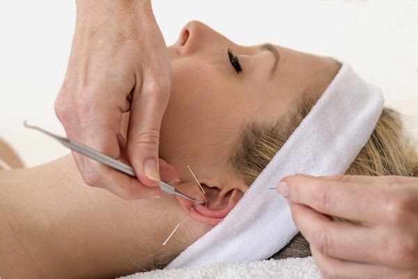 New Study: Ear Acupuncture Could Help You Get Rid of Those Extra Pounds