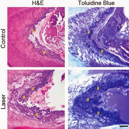 Noninvasive Laser Fixes Teeth, Could Radically Change Dentistry