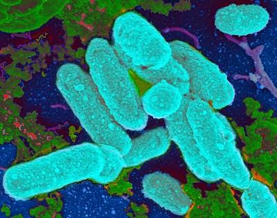 Scientist Finds Link Between Antibiotics and Chronic Infections