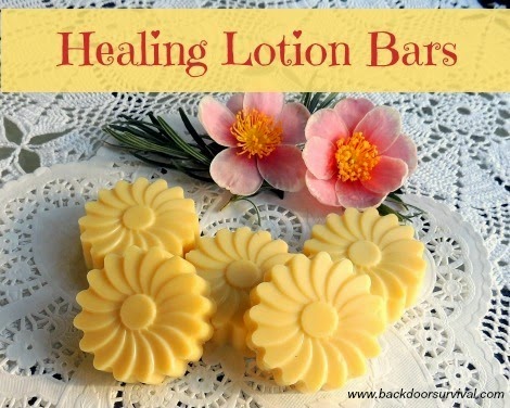 Make Your Own Healing Lotion Bars