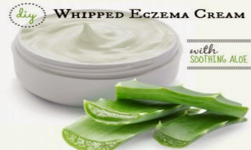 DIY: Whipped Eczema Cream with Soothing Aloe