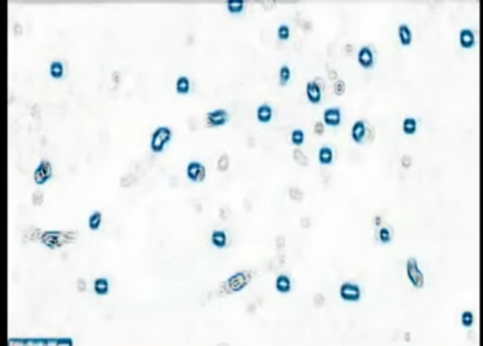 WATCH: Time Lapse of Cannabis Eating Cancer Cells