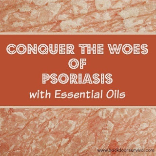 Treating Psoriasis with Essential Oils