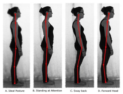 The Myth of Bad Posture and Misconceptions About ‘Correction’