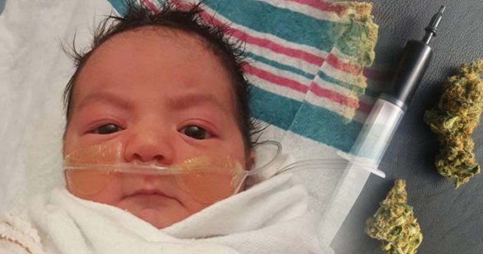 Meet the First Baby Ever Treated with Cannabis CBD Oil at The Hospital