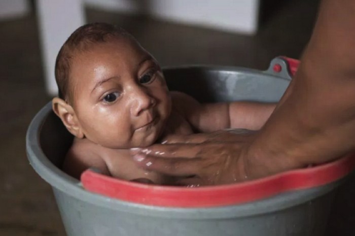 New Evidence Suggests Monsanto Larvicide Is To Blame For Birth Defects in Brazil