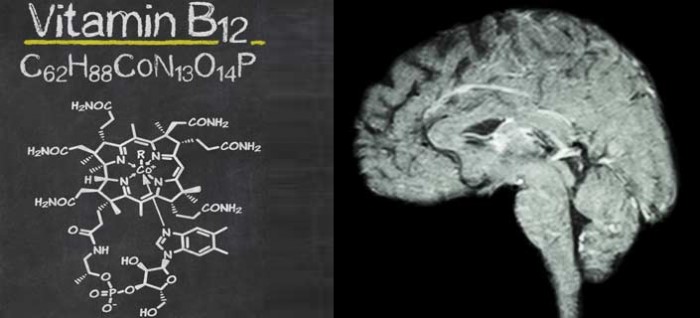Schizophrenia And Autism Linked To Low Levels Of Vitamin B12 In Brain