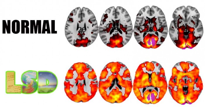 Scientists Just Took Images of the Brains of People on LSD and the Results are Revolutionary