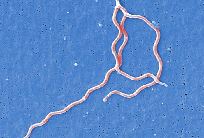 Lyme discovery: Borrelia bacteria hides inside parasitic worms, causing chronic brain diseases