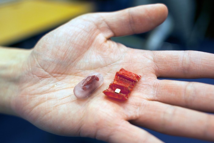 Origami Robot Heralds New Possibilities and Concerns For Ingestible Medicine