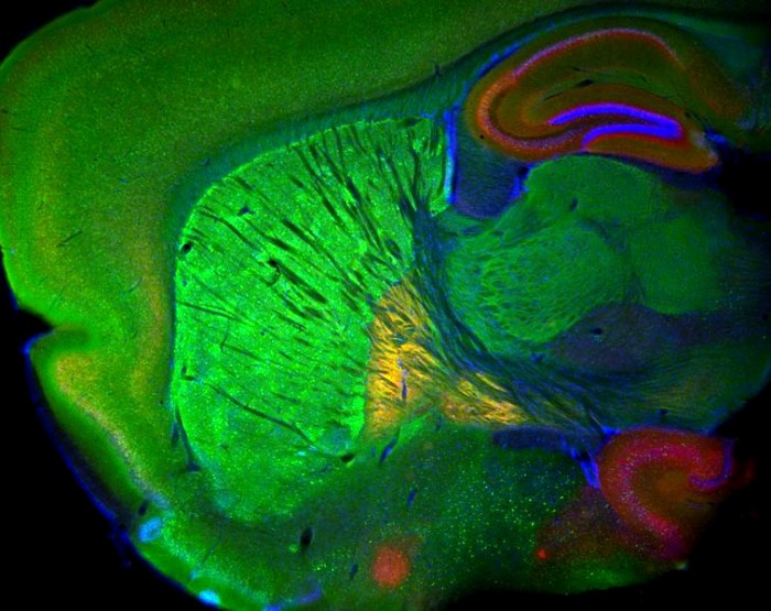 Neuroscientists Discover Previously Mysterious Function of Cannabinoid Receptor