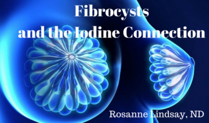 Fibrocysts And The Iodine Connection