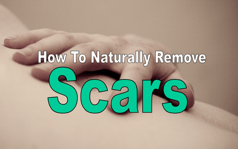 remove-scars-naturally