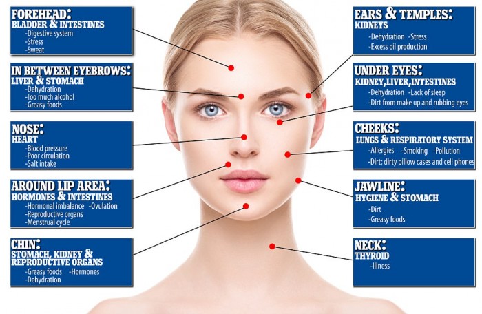 Facial Blemish Map Reveals These Internal Health Problems