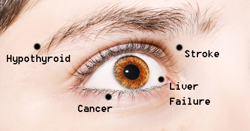 eye signs of health