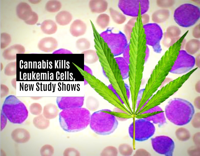 cannabis kills leukemia cells