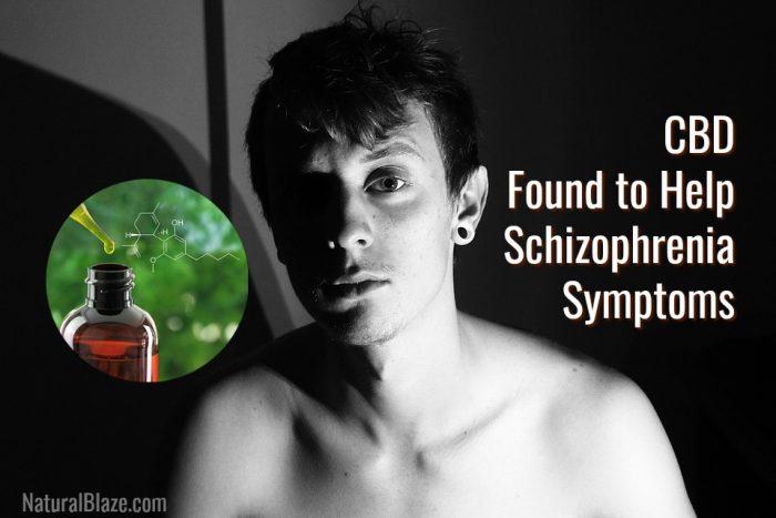 CBD Can Improve Schizophrenia Symptoms, Study Finds