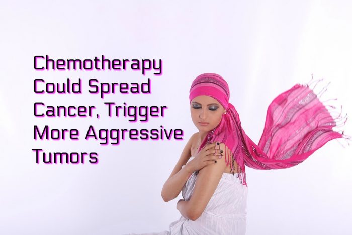 Scientists Warn Chemotherapy Could Spread Cancer, Trigger More Aggressive Tumors