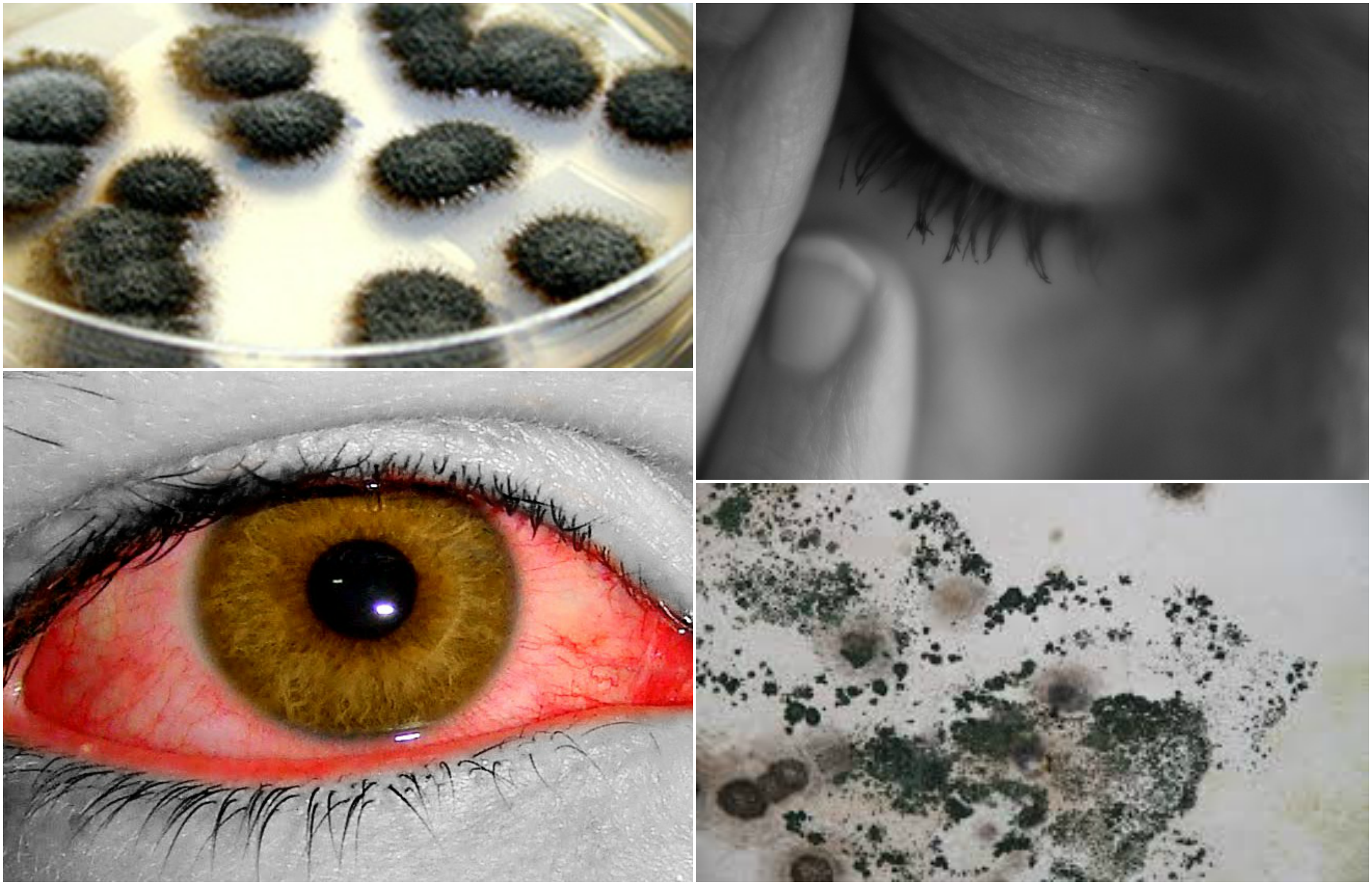 17 Signs You May Have A Mold Illness By Aaron Kesel Mold Illness