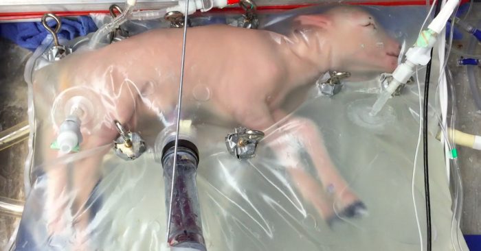“Don’t Call Me Mother,” Artificial Womb Grew Baby Sheep, Humans Next