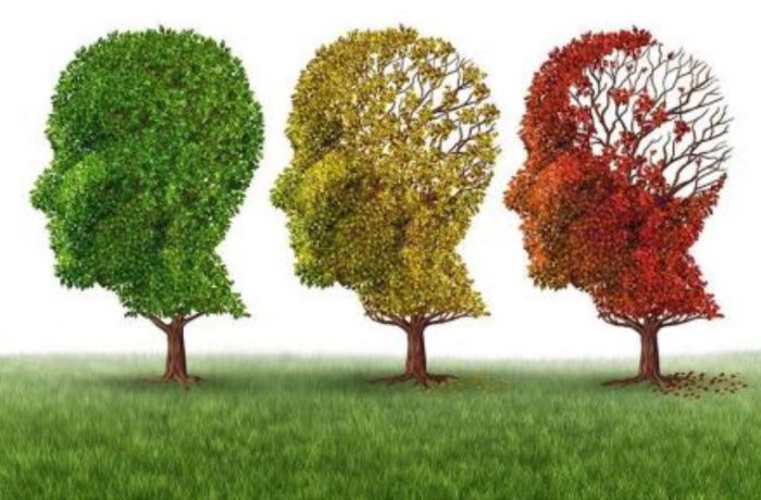 Big Pharma’s Alzheimer’s Drug Failure: Will There Be a Vaccine for Alzheimer’s?