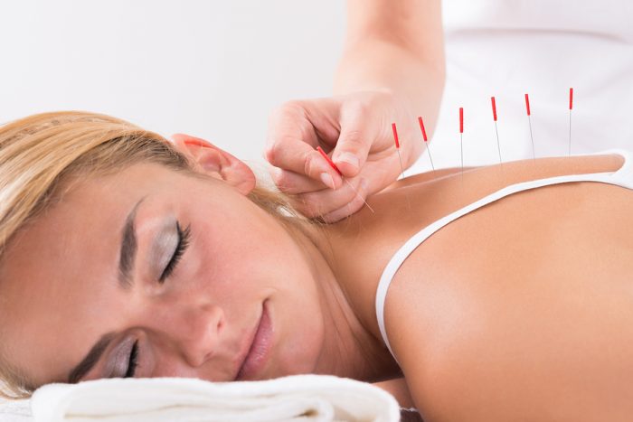 I tried acupuncture once… and it didn’t work