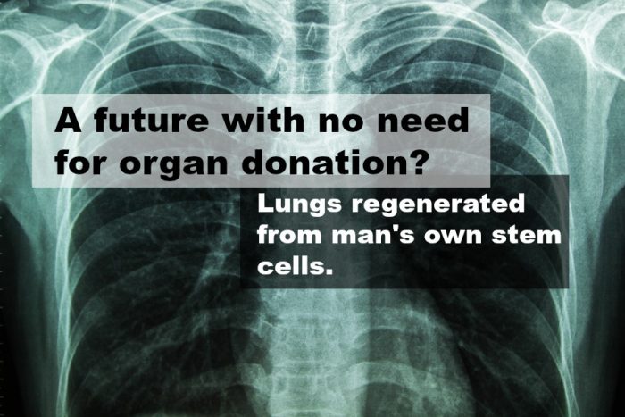 Goodbye Organ Donation – Scientists Generated Healthy Lung Tissue From Man’s Own Stem Cells