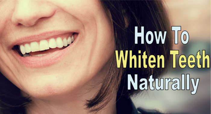 7 Weird Ways to Whiten Teeth Naturally