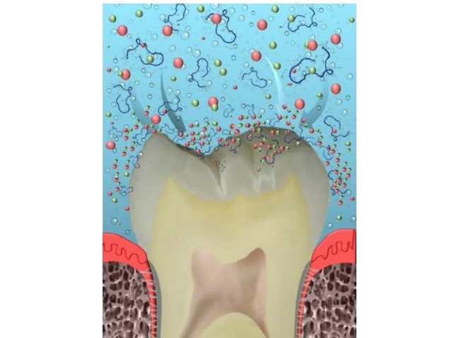 Future Dental Product May Cure Cavities