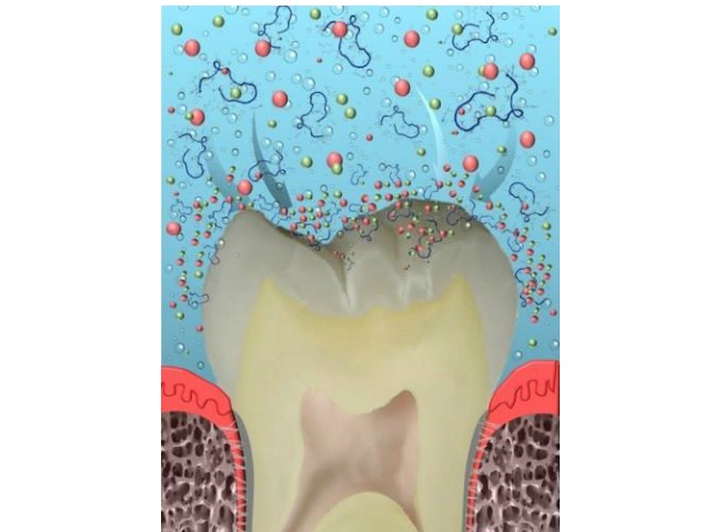 Future Dental Product May Cure Cavities