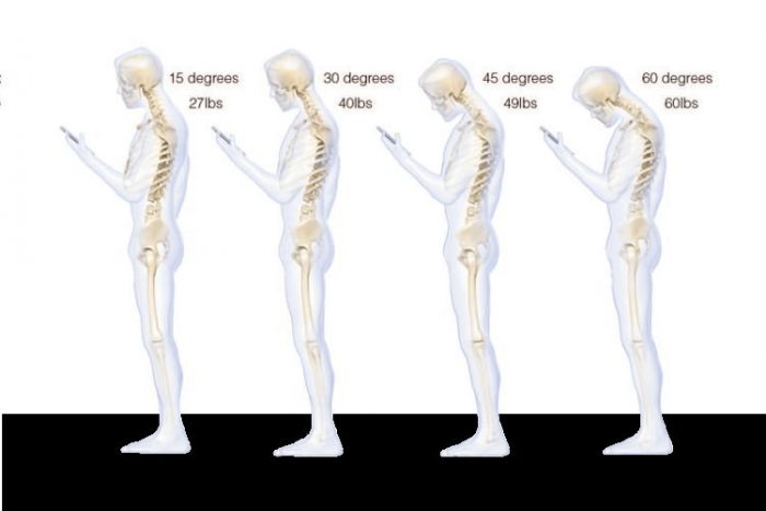 Surgeon Reveals Why Texting Causes So Much Neck Stress