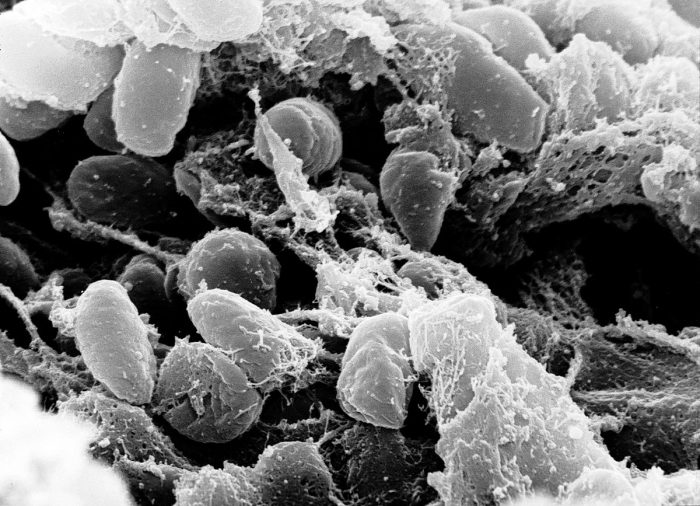 Bubonic Plague Found In Idaho Child, First Case Since 1992