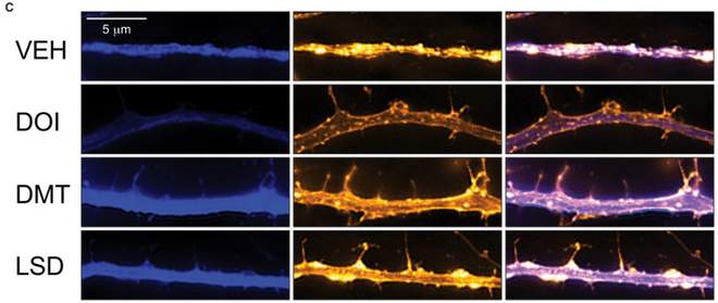 Psychedelics Shown to Heal Damaged Brain Cells from Depression Dendrite-connections