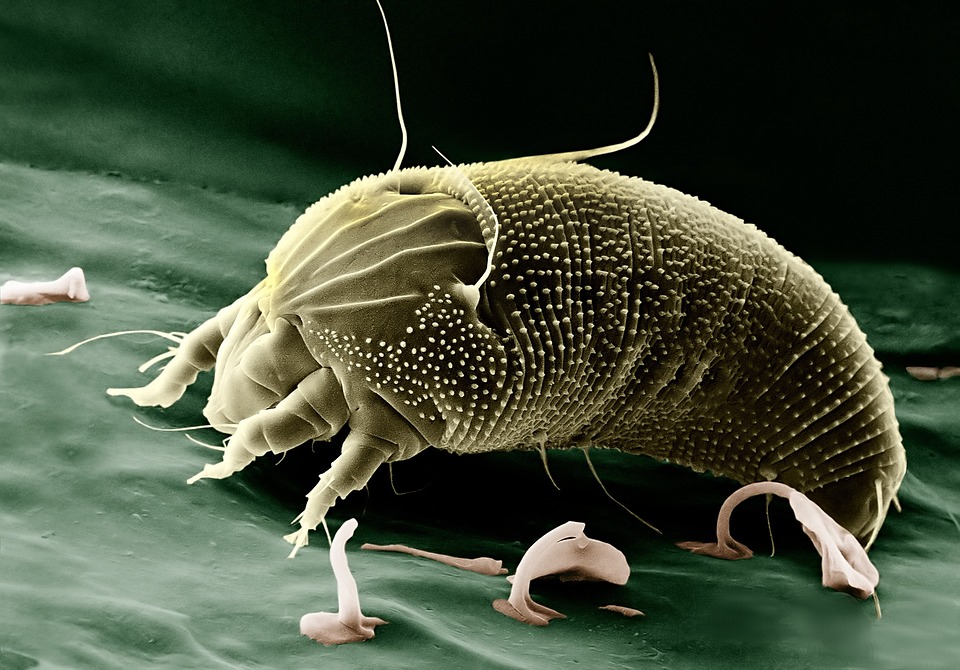 11 Tips to Get Rid of Dust Mites Naturally