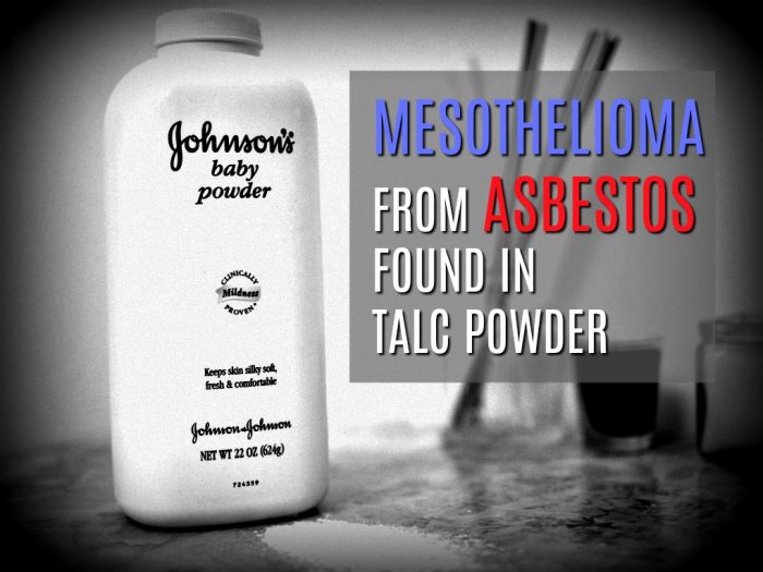 Cancer Victims Sue Johnson & Johnson Over Mesothelioma From Asbestos in Talc Powder