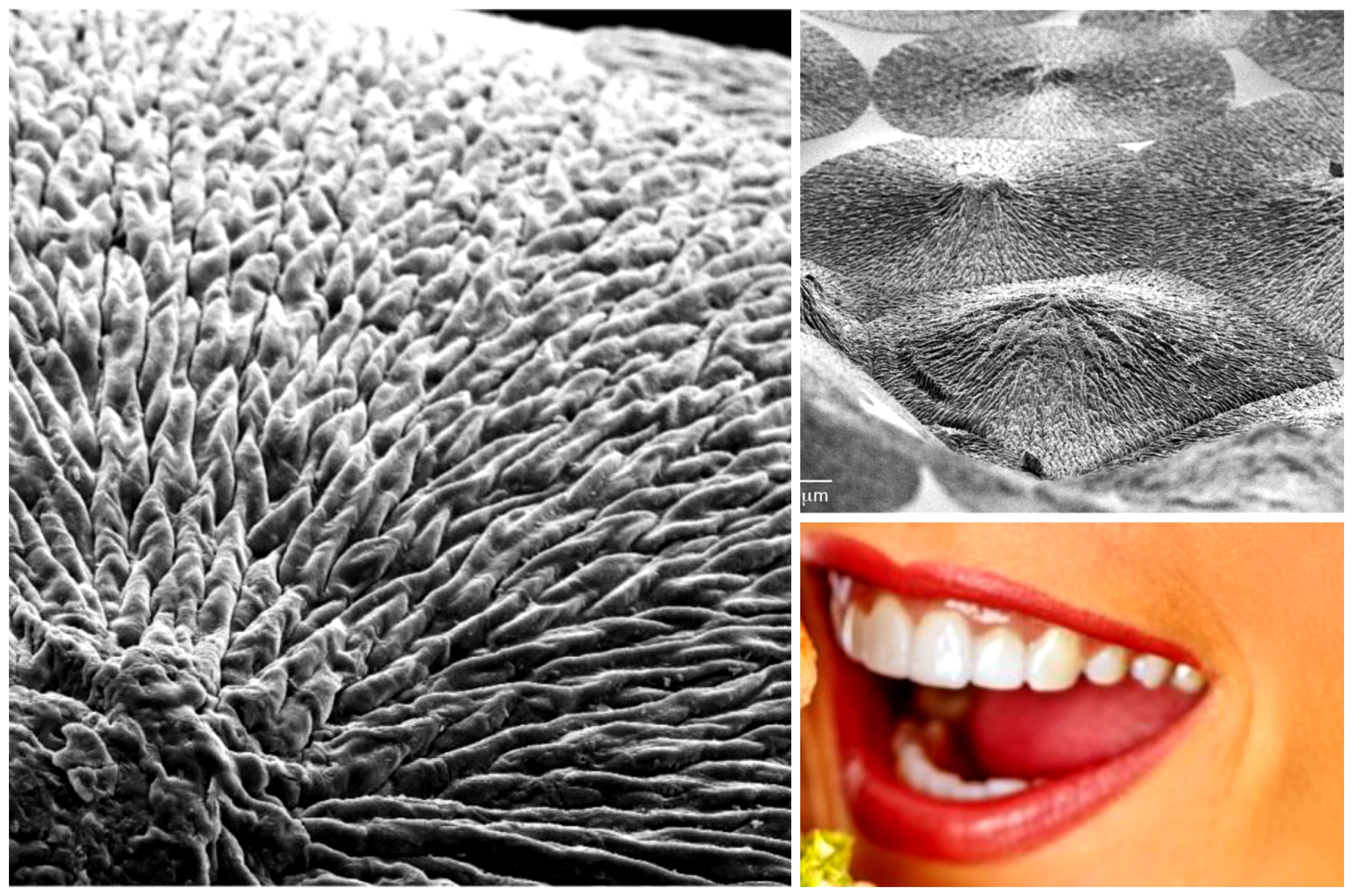 Scientists Just Developed NEW Material that Can Regenerate Dental Enamel