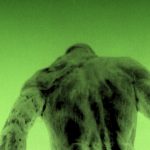 The Anxiety Epidemic, Antidepressants and CBD