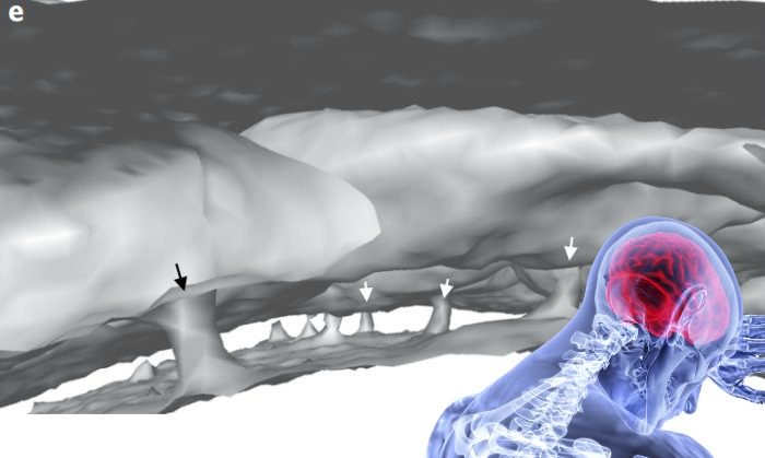 Scientists Discover Bizarre Tunnels Between the Skull and The Brain of Humans And Mice