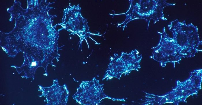 Israeli Scientists Announce “Complete Cure” for Cancer is Coming Soon