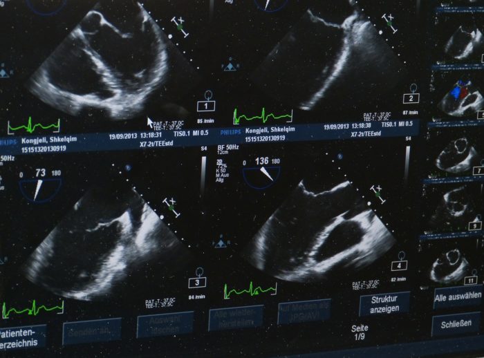 Shocker: The Dangers of Ultrasound