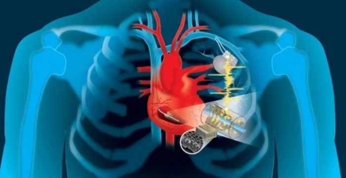 Pacemakers Could Soon Be Powered by Our Heartbeats Rather Than Batteries