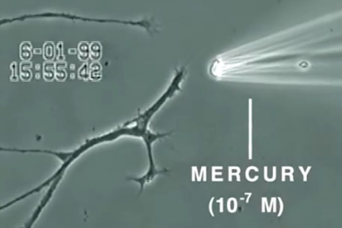Watch What Mercury Does to a Brain Neuron in Just 20 Minutes