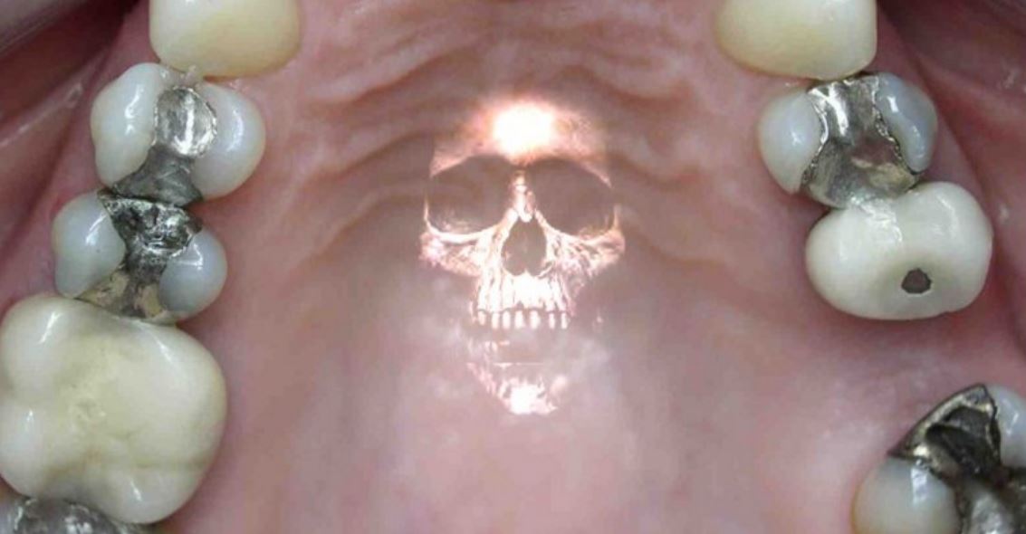 Wireless Technology Ultra Convenient. Delivers Mercury Vapor from