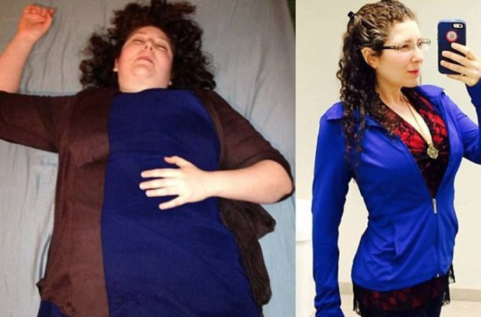 Woman Claims A Fruitarian Diet Helped Her Lose 80 Lbs, Reverse Her MS, And Clear Acne