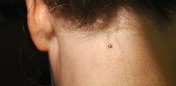 Ticks Spread Plenty More For You To Worry About Beyond Lyme Disease