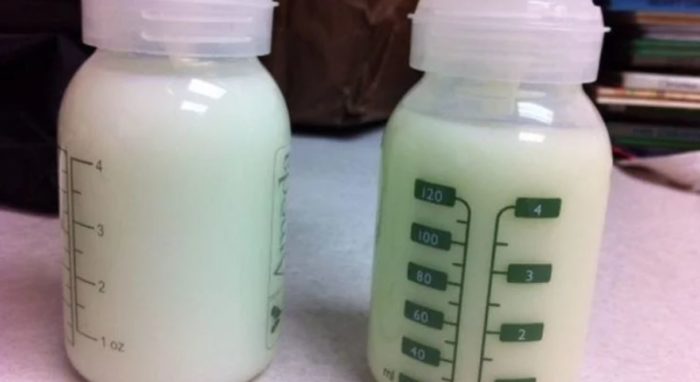 Natural Chemical in Breast Milk Dissolves Cancer Tumors, Trial Shows