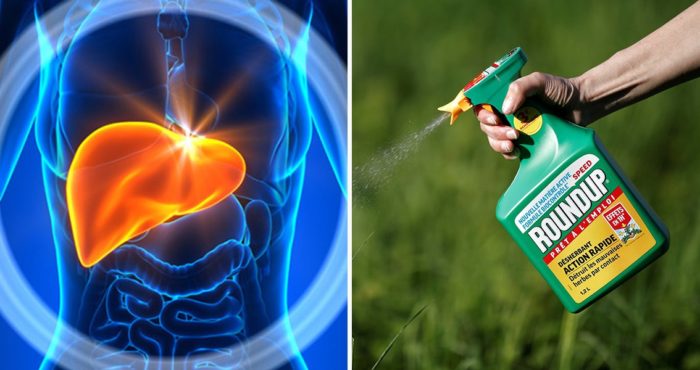 New Study Finds Strong Link Between Glyphosate & Human Liver Disease